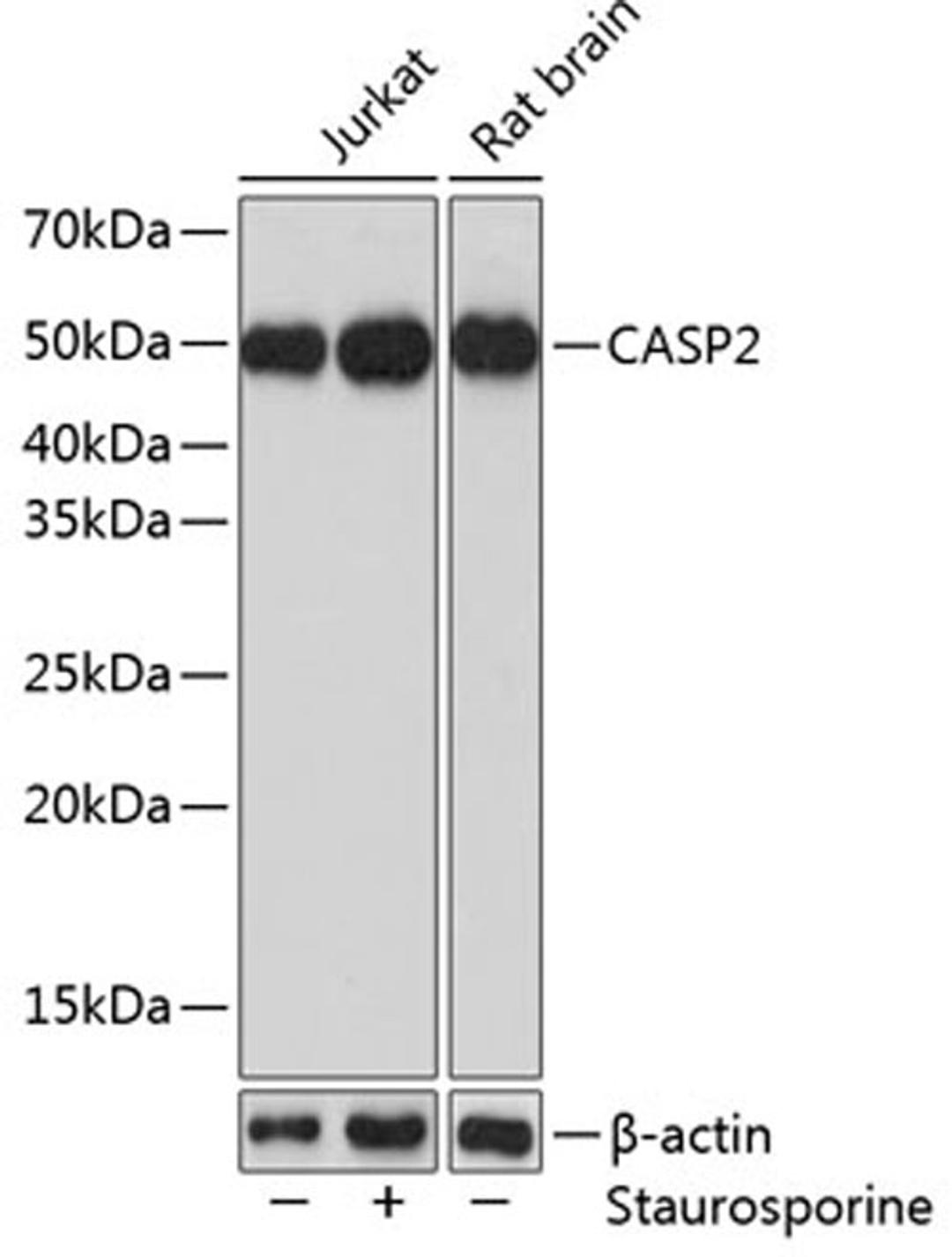 Western blot - CASP2 Polyclonal Antibody (A5724)