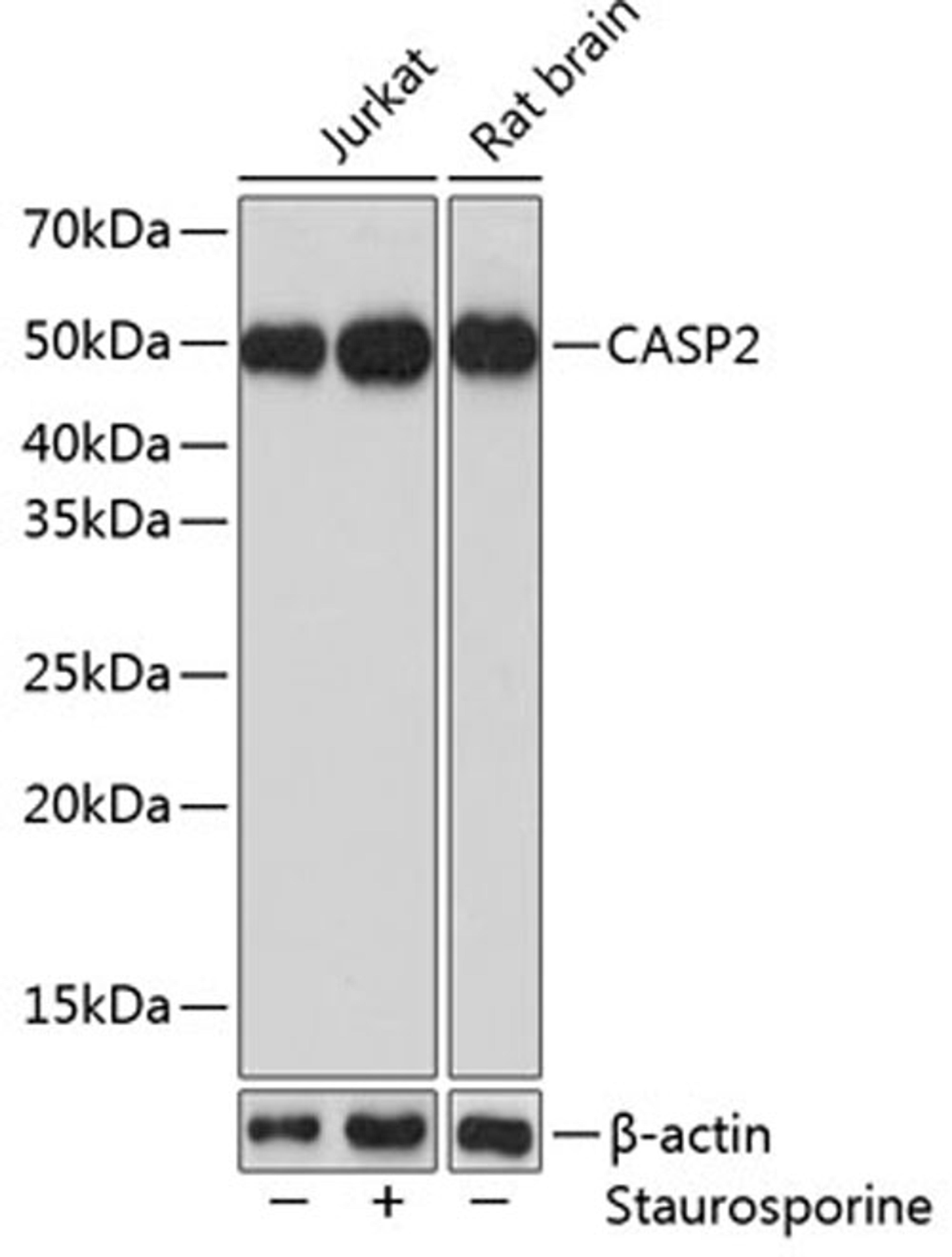 Western blot - CASP2 Polyclonal Antibody (A5724)