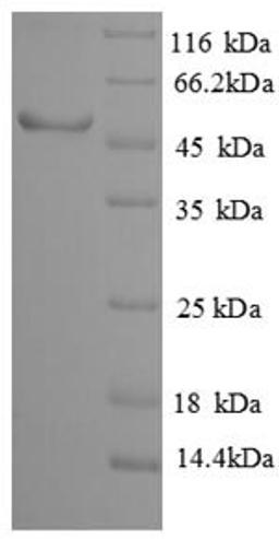 (Tris-Glycine gel) Discontinuous SDS-PAGE (reduced) with 5% enrichment gel and 15% separation gel.