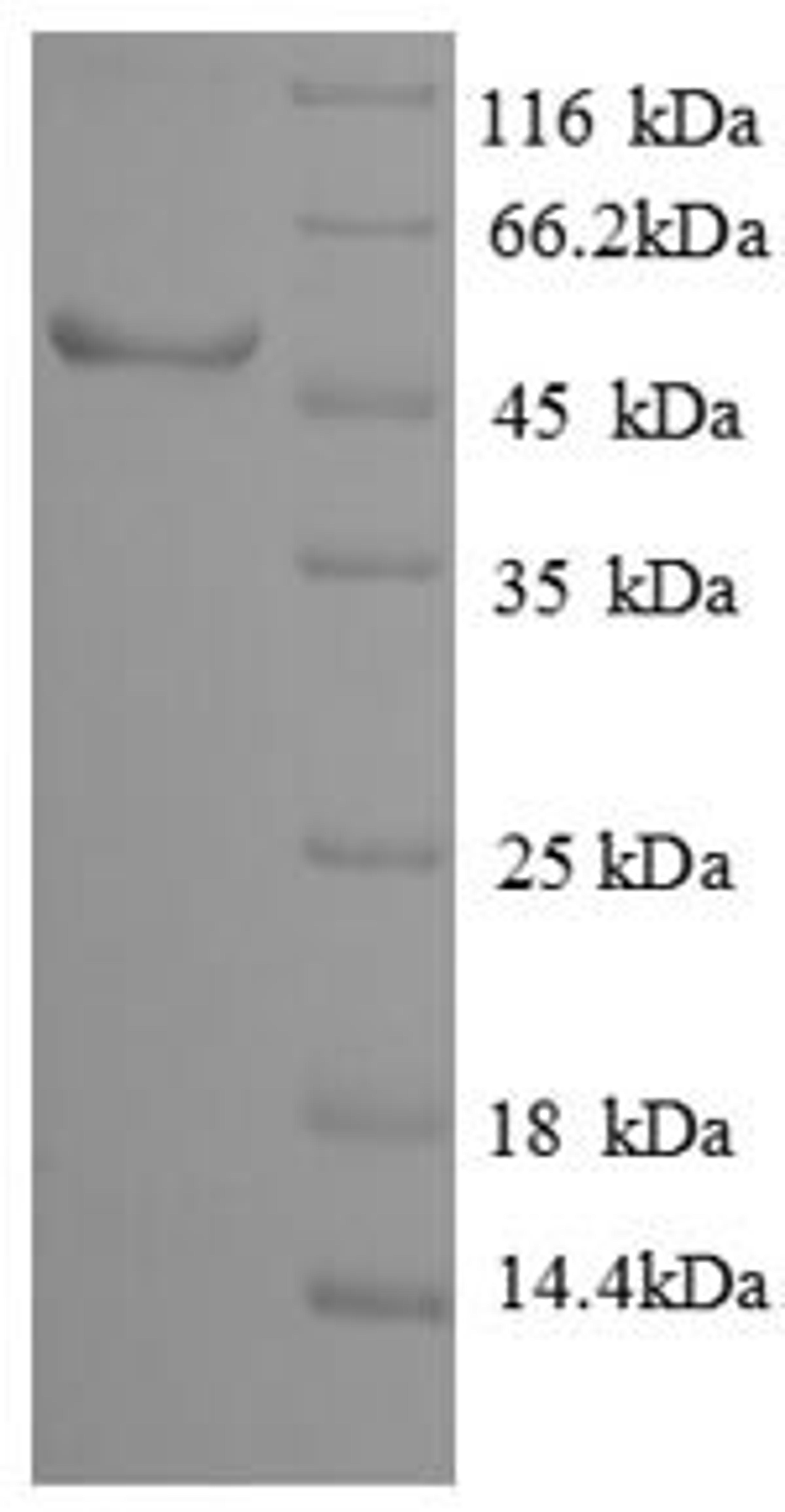(Tris-Glycine gel) Discontinuous SDS-PAGE (reduced) with 5% enrichment gel and 15% separation gel.