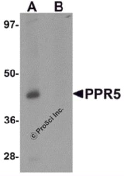 Western blot analysis of PRR5 in SK-N-SH cell lysate with PRR5 antibody at 1 &#956;g/mL in (A) the absence and (B) the presence of blocking peptide