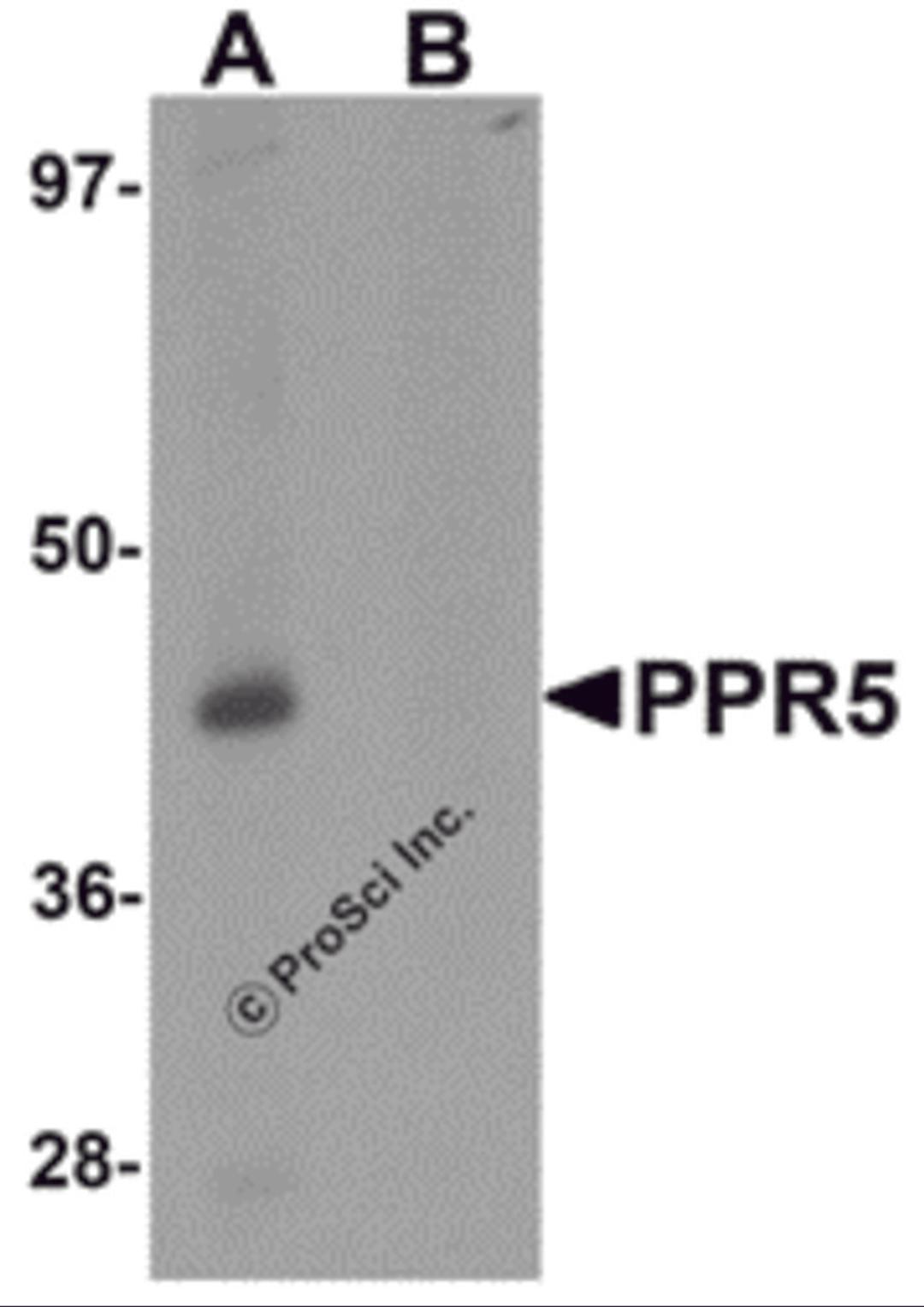 Western blot analysis of PRR5 in SK-N-SH cell lysate with PRR5 antibody at 1 μg/mL in (A) the absence and (B) the presence of blocking peptide
