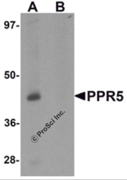 Western blot analysis of PRR5 in SK-N-SH cell lysate with PRR5 antibody at 1 μg/mL in (A) the absence and (B) the presence of blocking peptide