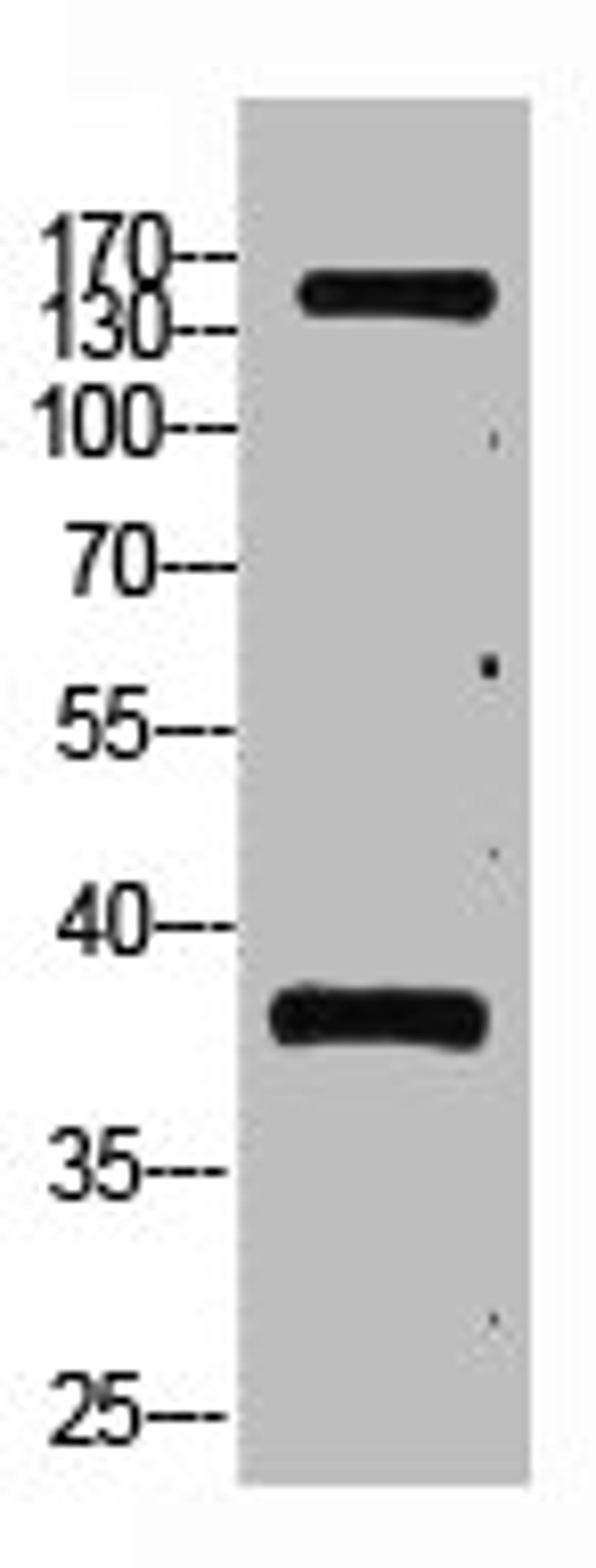 Western blot analysis of Hela, diluted at 1:2000.