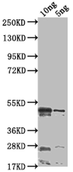 Western Blot. Positive WB detected in Recombinant protein. All lanes: rsad2 antibody at 1:2000. Secondary. Goat polyclonal to rabbit IgG at 1/50000 dilution. Predicted band size: 44.1 kDa. Observed band size: 44 kDa.