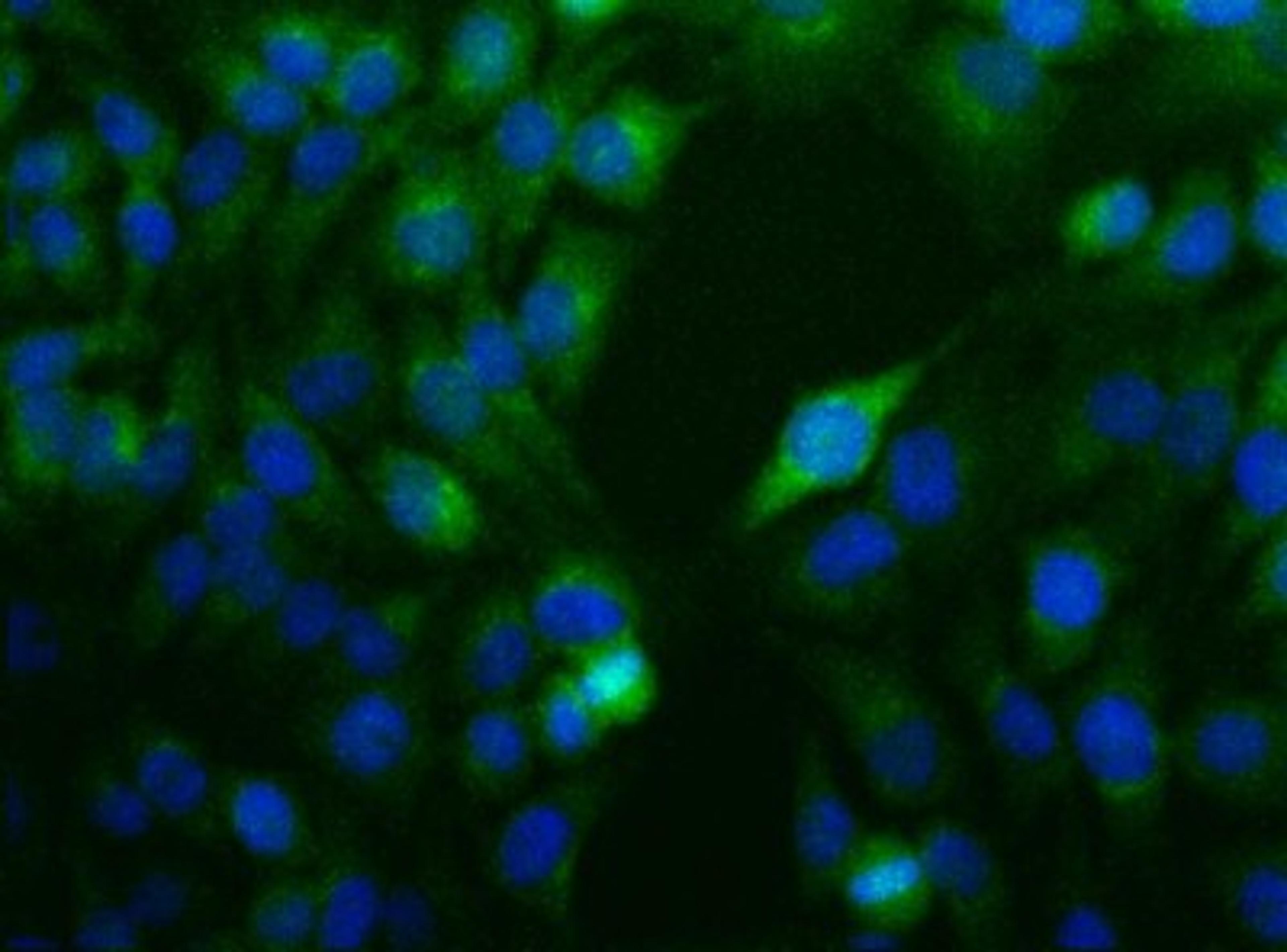 Immunocytochemistry/Immunofluorescence: Nodal Antibody [NBP1-71686] - ICC staining of NODAL in HeLa cells.