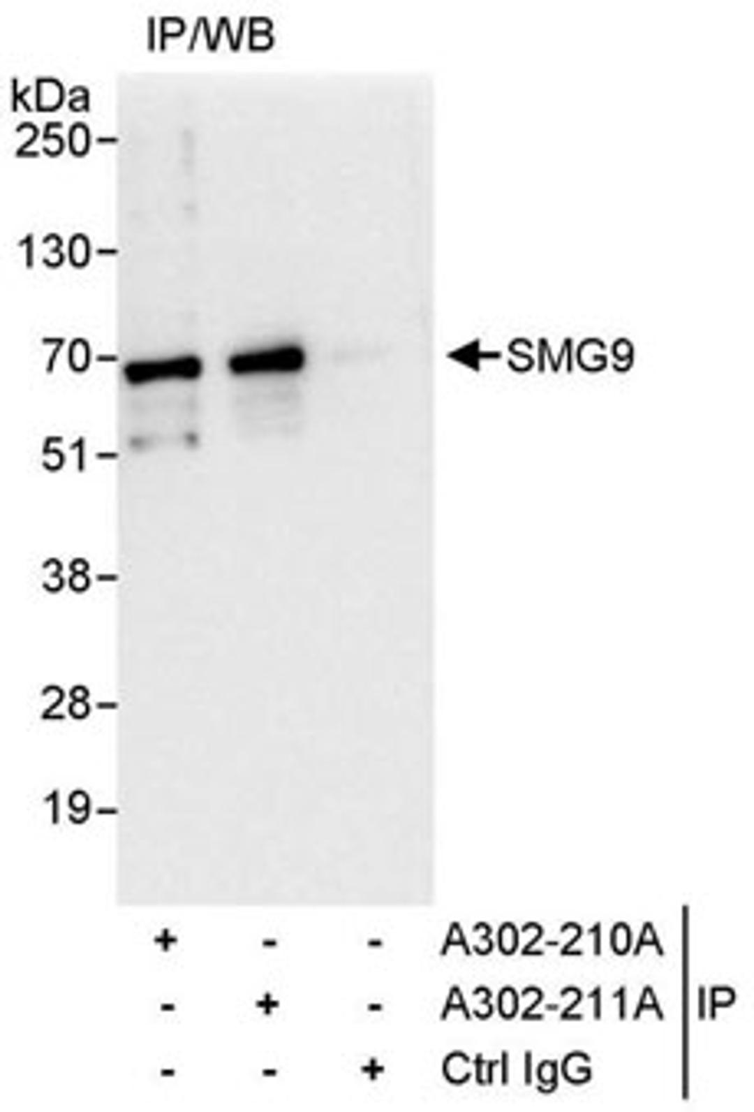 Detection of human SMG9 by western blot of immunoprecipitates.