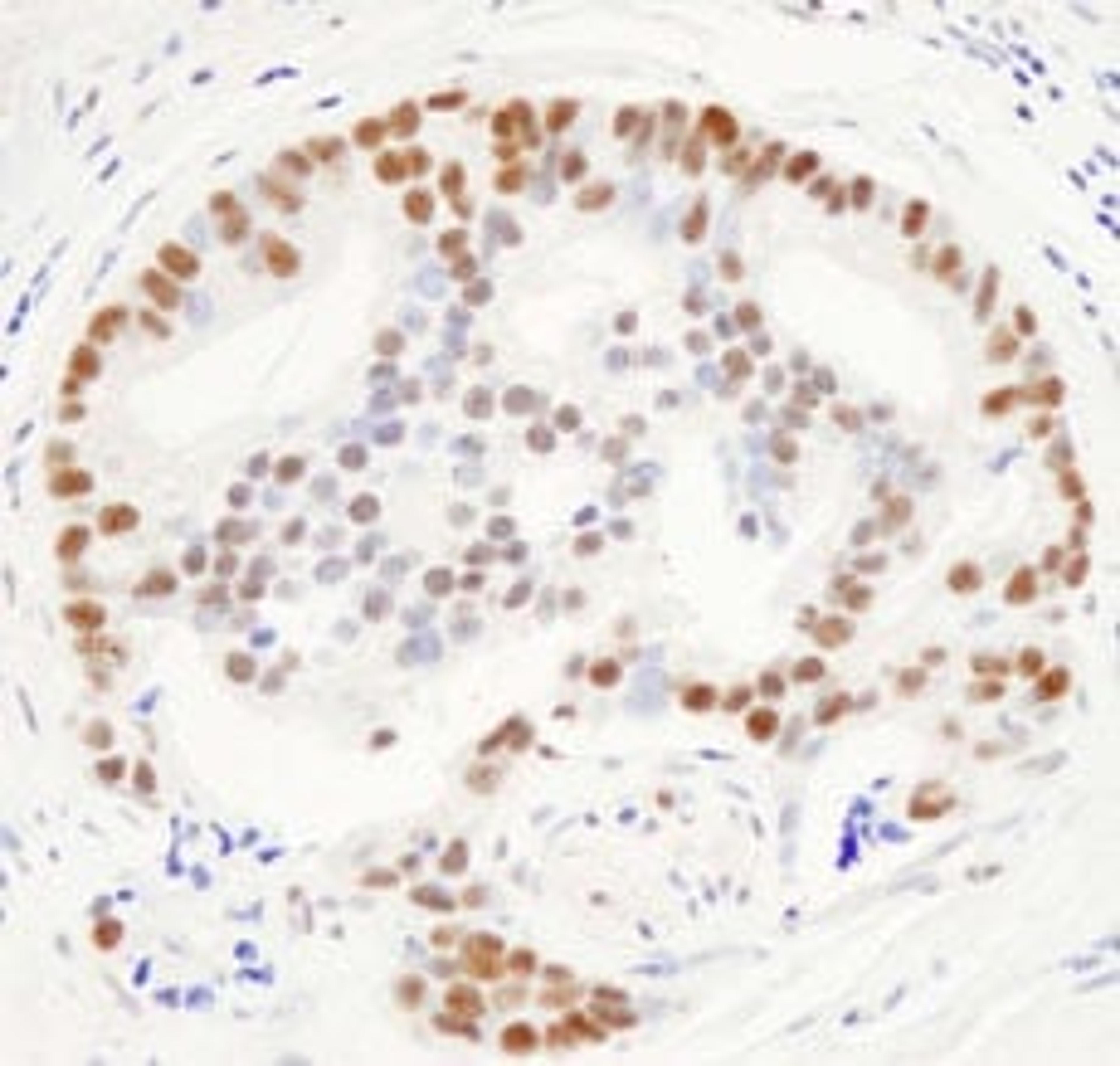 Detection of human THRAP3/TRAP150 by immunohistochemistry.