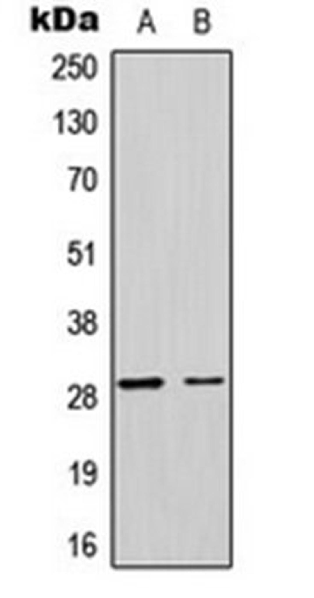 Western blot analysis of U251MG (Lane 1), HeLa (Lane 2) whole cell lysates using MRPL17 antibody