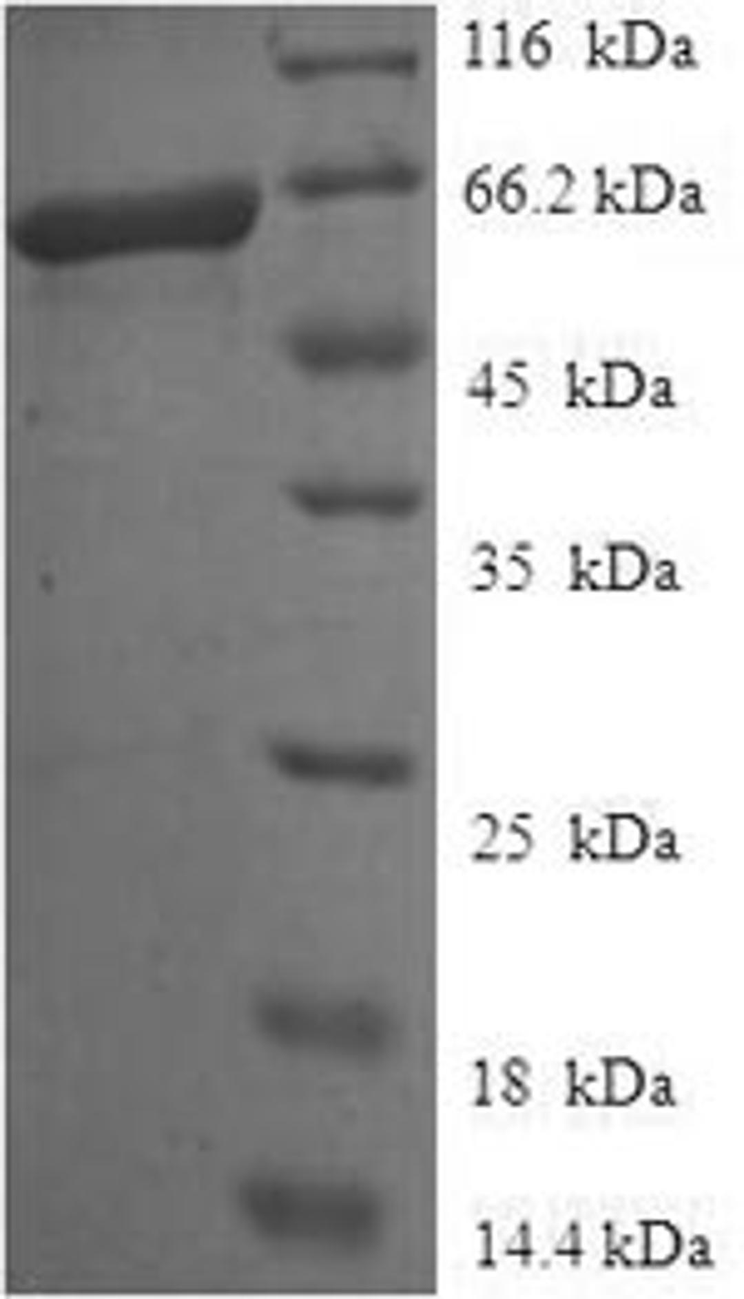 (Tris-Glycine gel) Discontinuous SDS-PAGE (reduced) with 5% enrichment gel and 15% separation gel.