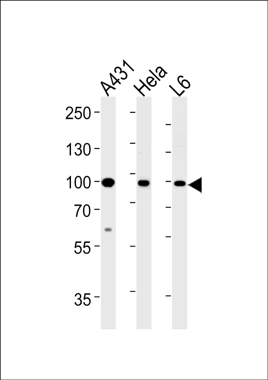 Western blot analysis in A431,Hela,L6 cell line lysates (35ug/lane).This demonstrates the HSP90AB1 antibody detected the HSP90AB1 protein (arrow).