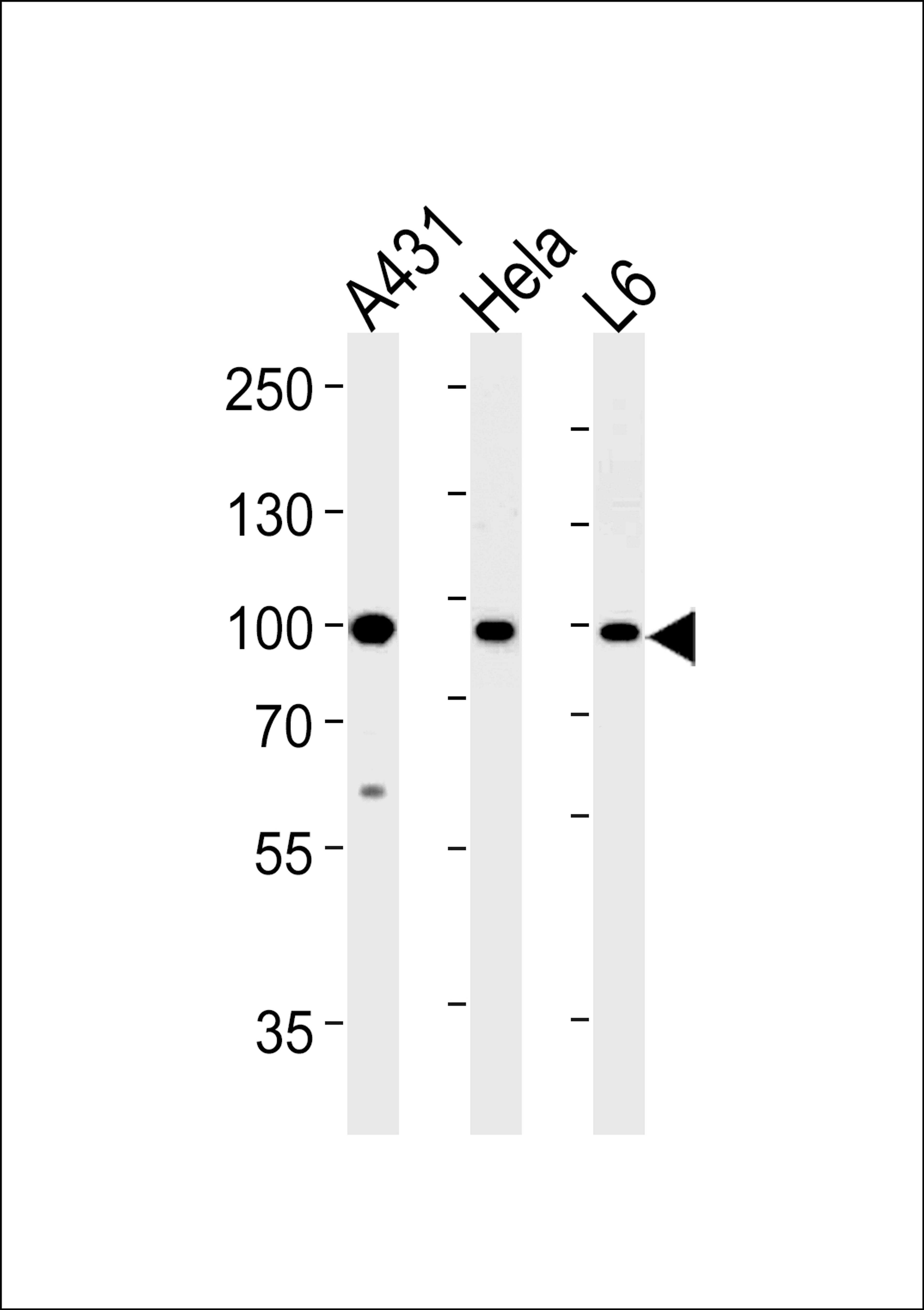 Western blot analysis in A431,Hela,L6 cell line lysates (35ug/lane).This demonstrates the HSP90AB1 antibody detected the HSP90AB1 protein (arrow).