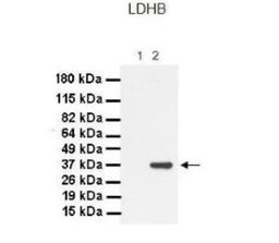 Western Blot: Lactate Dehydrogenase B Antibody [NBP1-55415] - Lanes: 1. 30 ug MiaPaca-2 cell lysate 2. 30 ug Panc-1 cell lysate Primary, Antibody Dilution: 1 : 1000 Secondary Antibody: Goat anti-Rabbit HRP Secondary, Antibody Dilution: 1 : 4000 Gene name: LDHB.