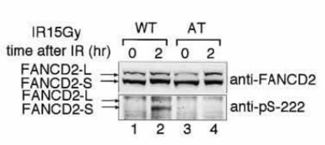 Western Blot: FANCD2 [p Ser222] Antibody [NB100-502] - Indicated lymphoblasts (PD7, WT: GM1526, AT) were irradiated with 15 Gy (2), and immunoblotted with anti-FANCD2 and anti-FANCD2 (pS-222)