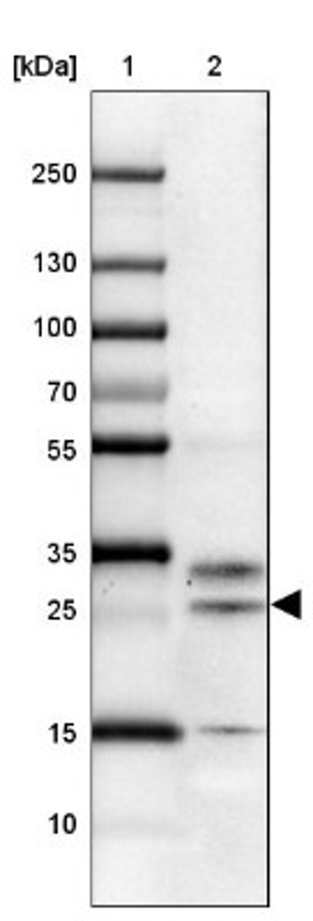 Western Blot: CRISP-3 Antibody [NBP2-33714] - Lane 1: Marker [kDa] 250, 130, 100, 70, 55, 35, 25, 15, 10<br/>Lane 2: esophagus