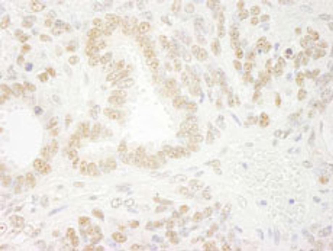 Detection of mouse ZNF198 by immunohistochemistry.