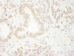 Detection of mouse ZNF198 by immunohistochemistry.