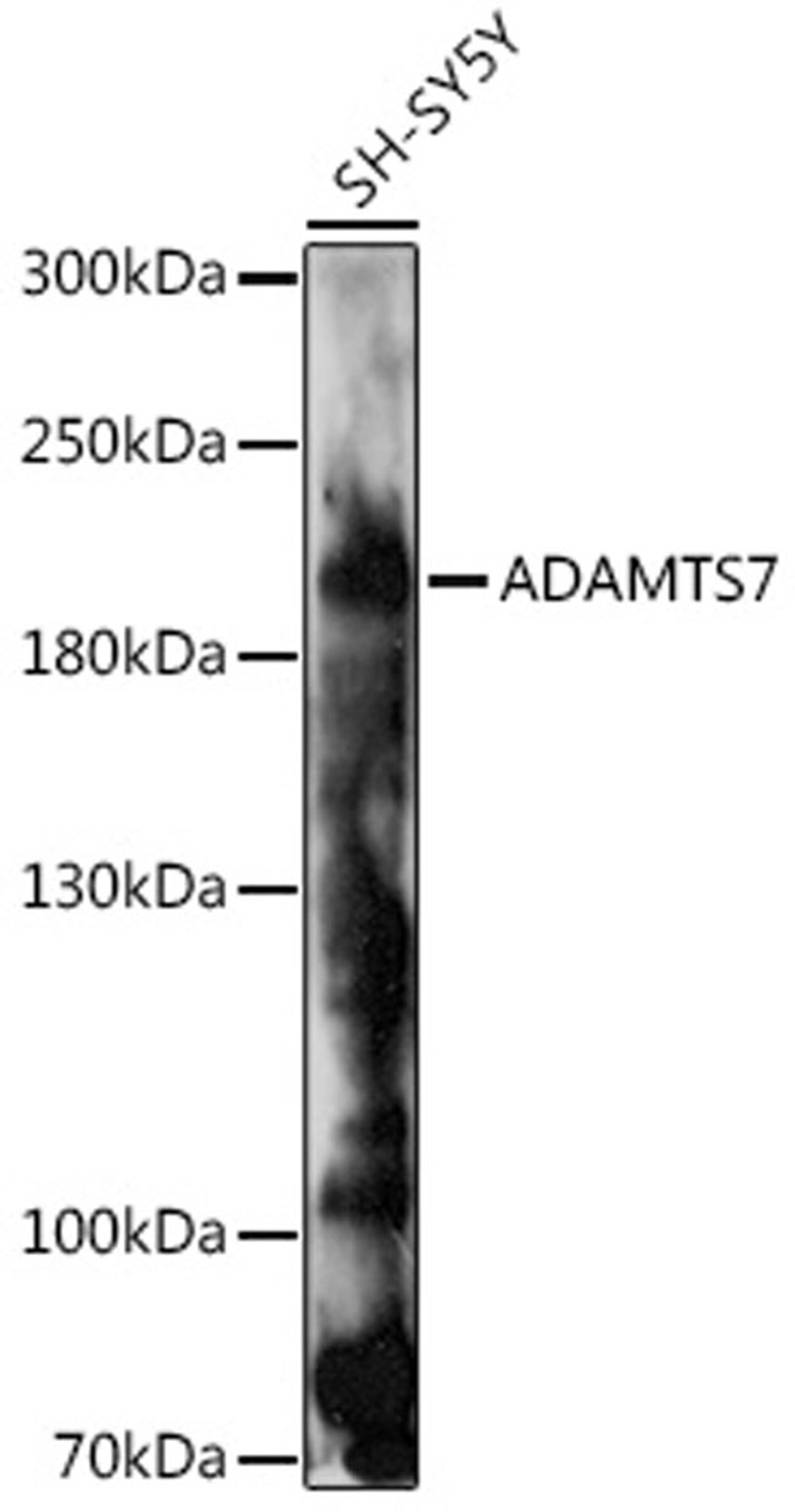 Western blot - ADAMTS7 antibody (A17093)