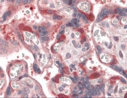 Immunohistochemistry of RIP1 in human placenta tissue with RIP1 antibody at 10 &#956;g/mL.