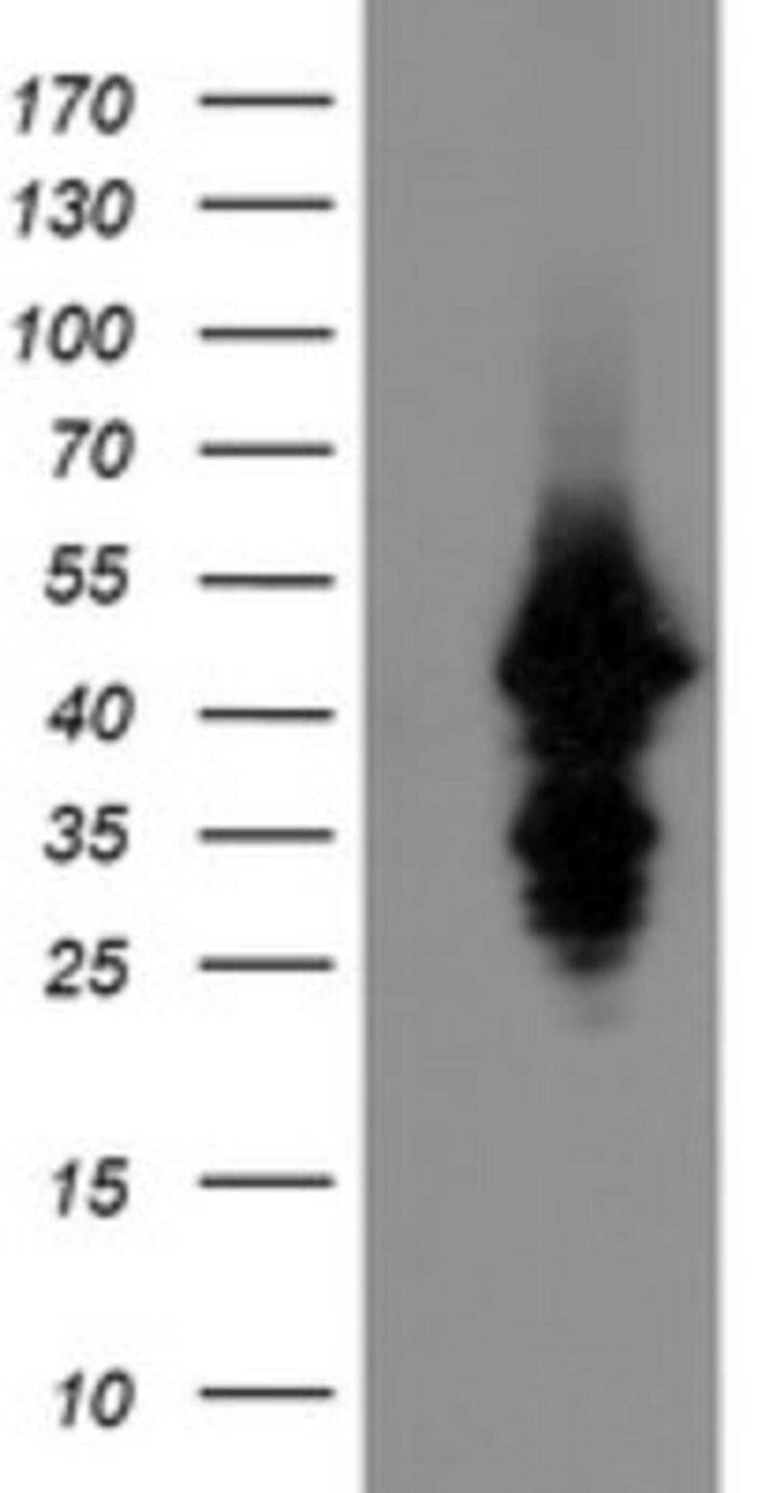 Western Blot: UBE2J1 Antibody (3D1) [NBP2-45402] - Analysis of HEK293T cells were transfected with the pCMV6-ENTRY control (Left lane) or pCMV6-ENTRY UBE2J1.