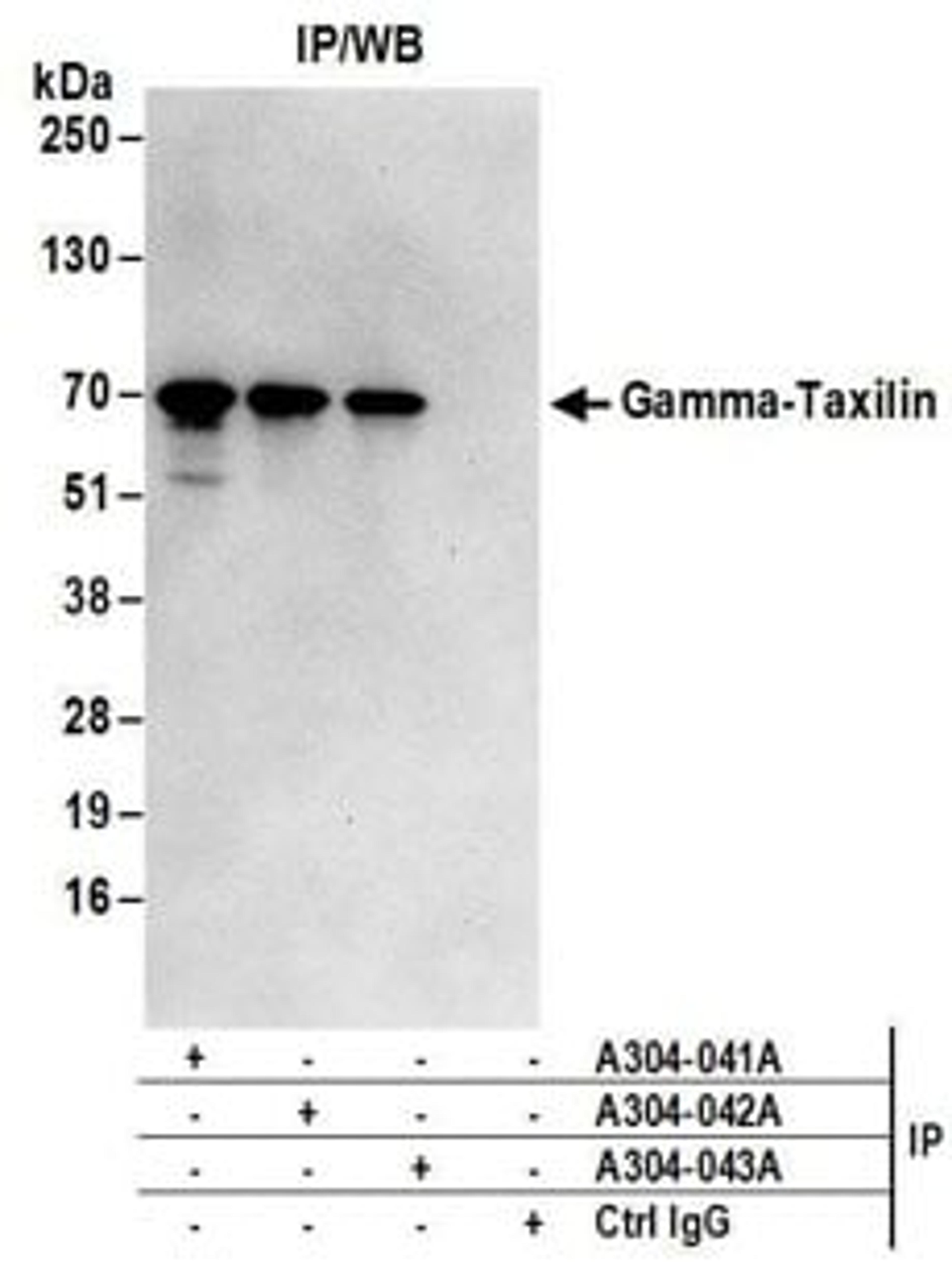 Detection of human Gamma-Taxilin by western blot of immunoprecipitates.