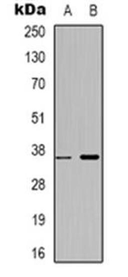 Western blot analysis of ZNF265 expression in HepG2 (Lane 1), MCF7 (Lane 2) whole cell lysates using ZRANB2 antibody