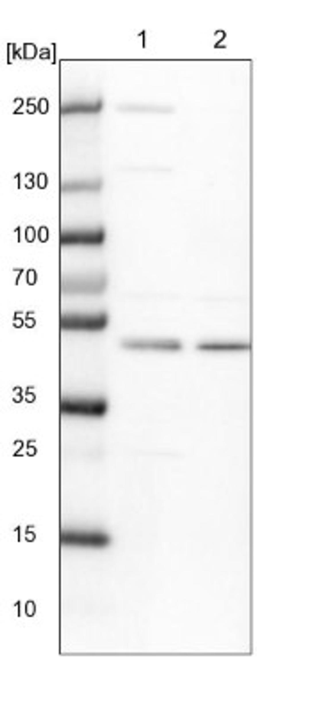 Western Blot: CHMP7 Antibody [NBP1-81133] - Lane 1: NIH-3T3 cell lysate (Mouse embryonic fibroblast cells)<br/>Lane 2: NBT-II cell lysate (Rat Wistar bladder tumour cells)