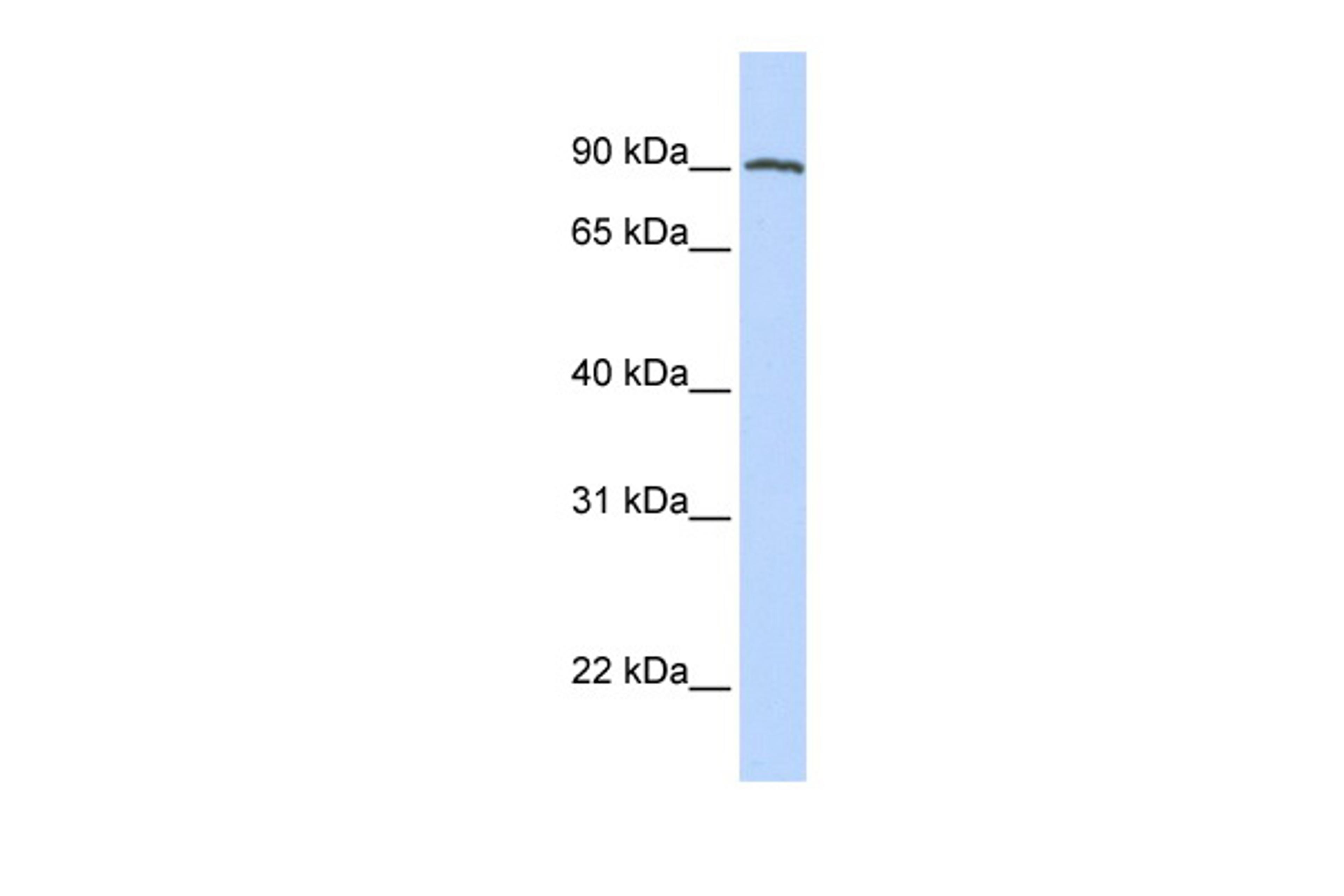 Antibody used in WB on Human Placenta at 0.2-1 ug/ml.