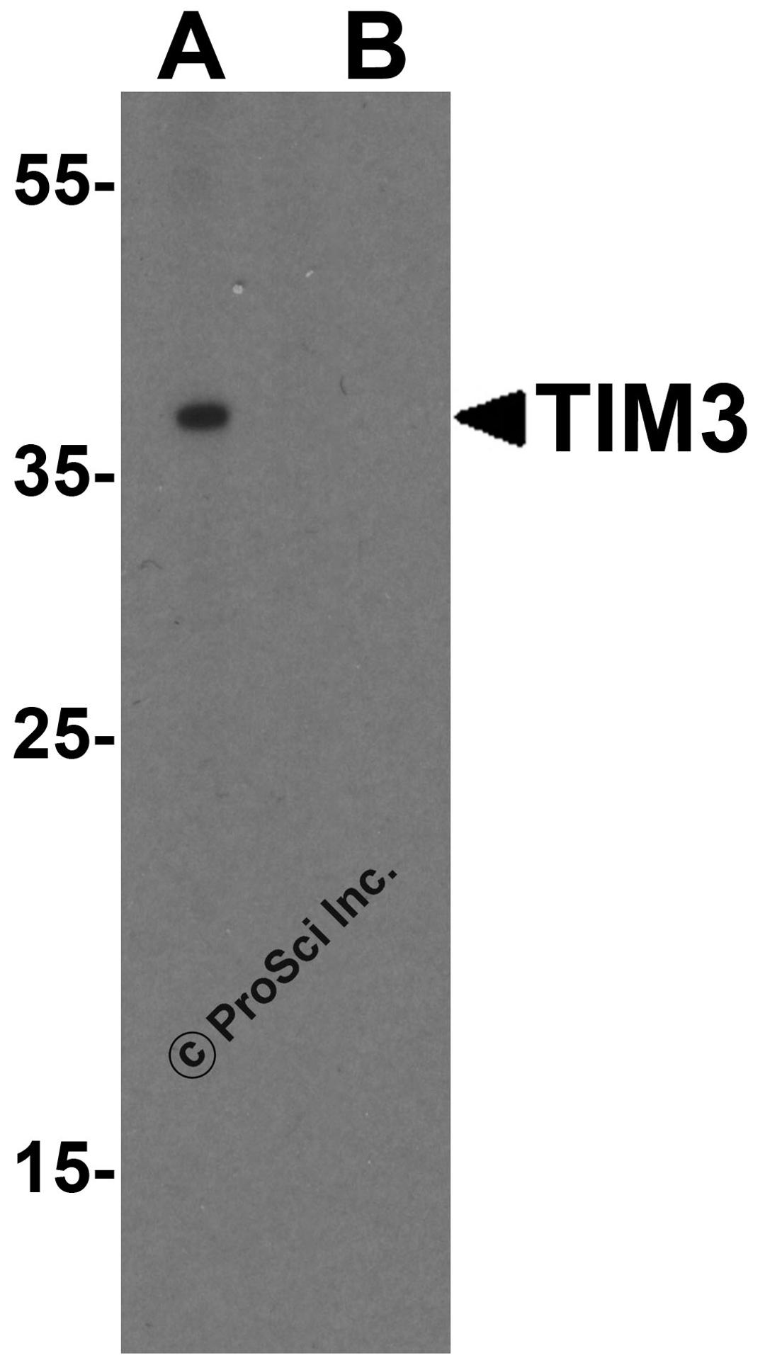 Western blot analysis of TIM-3 in Jurkat cell lysate with TIM-3 antibody at 1 μg/mL in (A) the absence and (B) the presence of blocking peptide.