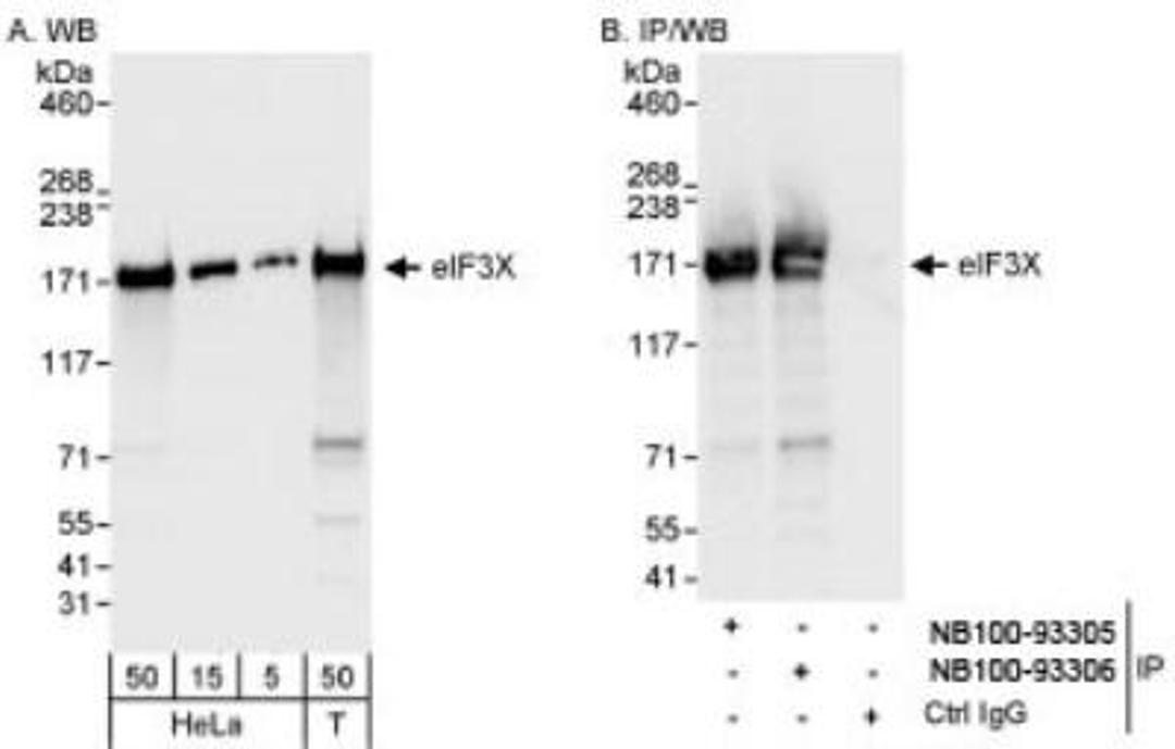 Western Blot: eIF3X Antibody [NB100-93306] - Samples: Whole cell lysate from HeLa (5, 15 and 50 mcg for WB; 1 mg for IP, 20% of IP loaded) and 293T (T; 50 mcg) cells.  Antibody: Affinity purified rabbit anti-eIF3X antibody NB100-93306 used for WB at 0.04 mcg/ml (A) and 1 mcg/ml (B) and used for IP at 3 mcg/mg lysate.  eIF3X was also immunoprecipitated by rabbit anti-eIF3X antibody NB100-93305, which recognizes an upstream epitope. For blotting immunoprecipitated eIF3X, the ReliaBLOT (R)  Reagents and Procedures (Cat. No. WB120) were used.  Detection: Chemiluminescence with exposure times of 3 seconds (A) and 1 second (B).