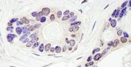 Detection of human TDP1 by immunohistochemistry.