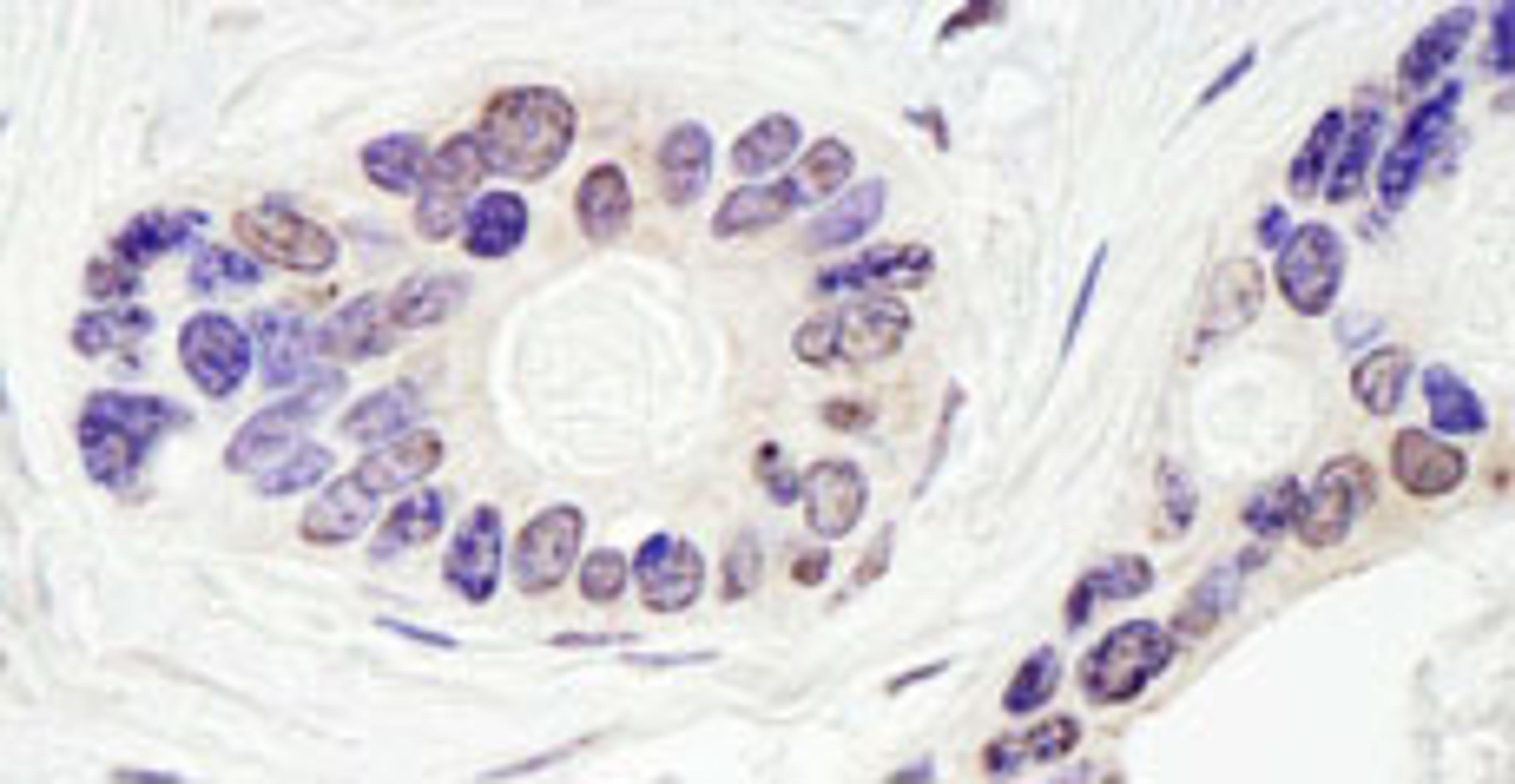 Detection of human TDP1 by immunohistochemistry.