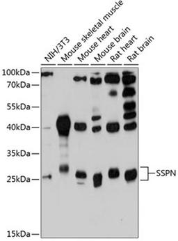 Western blot - SSPN antibody (A12191)