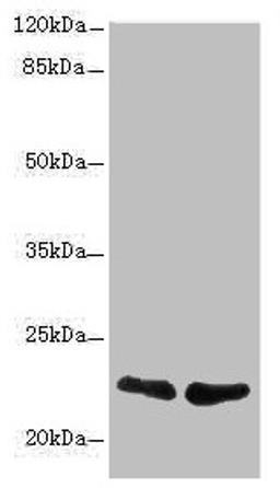 Western blot. All lanes: TNFAIP8 antibody at 2.32µg/ml. Lane 1: A431 whole cell lysate. Lane 2: PC-3 whole cell lysate. Secondary. Goat polyclonal to rabbit IgG at 1/10000 dilution. Predicted band size: 24, 23, 22, 25 kDa. Observed band size: 22 kDa