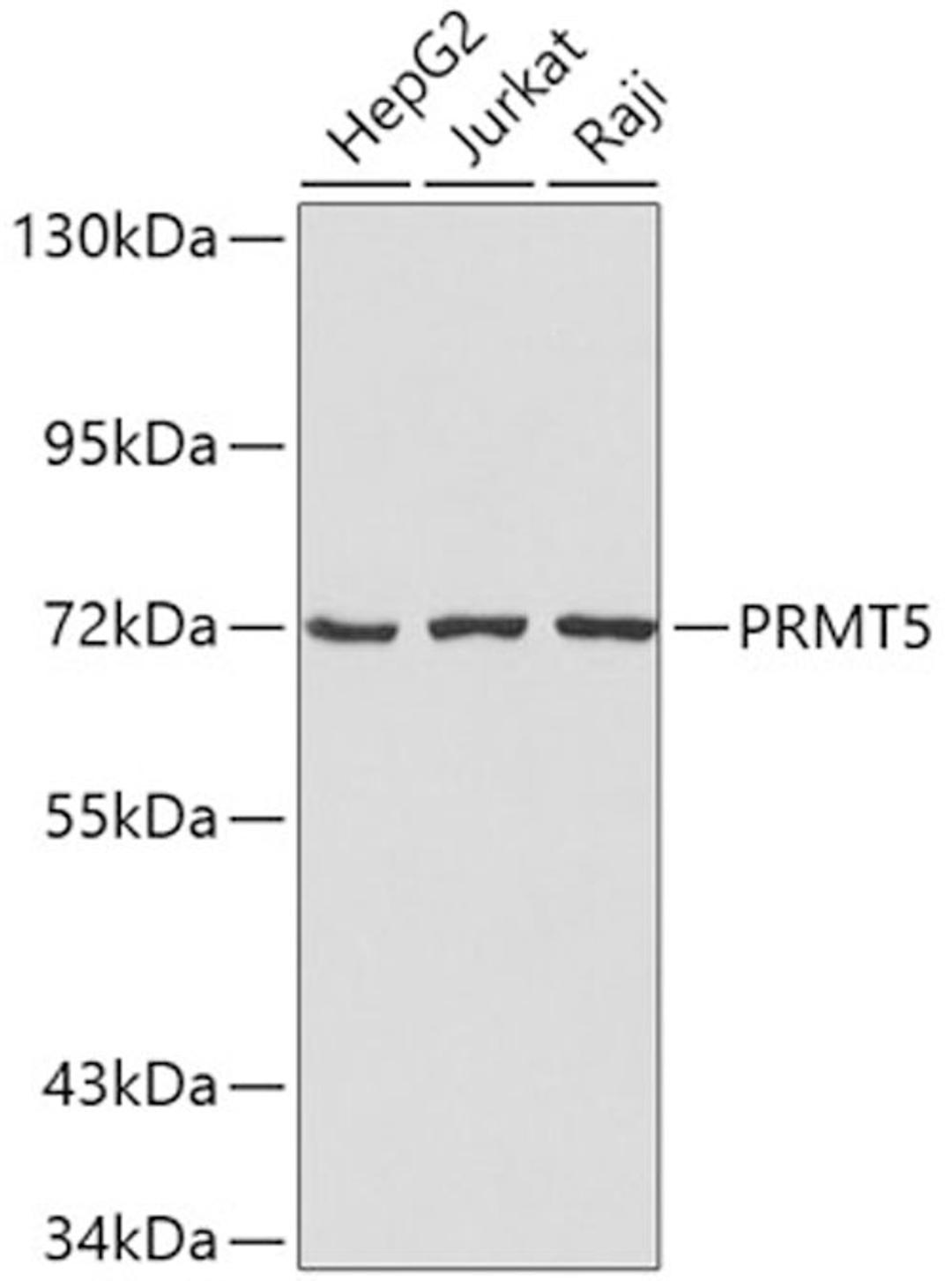 Western blot - PRMT5 antibody (A2290)