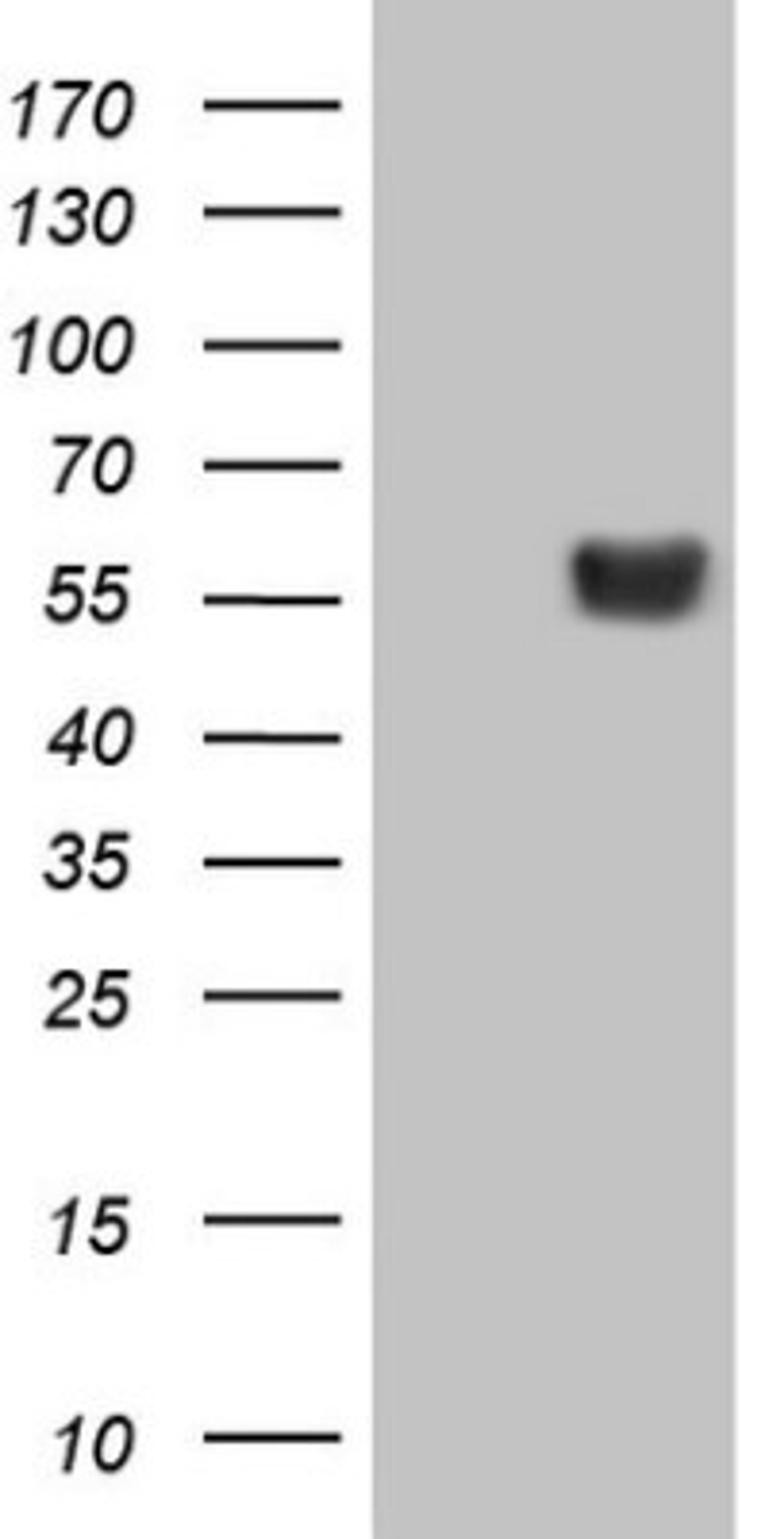 Western Blot: LRRC6 Antibody (7E9) [NBP2-45674] - Analysis of HEK293T cells were transiently transfected with the pCMV6-ENTRY control (Left lane) or pCMV6-ENTRY LRRC6 .