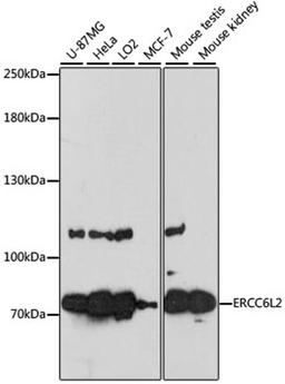 Western blot - ERCC6L2 antibody (A13144)