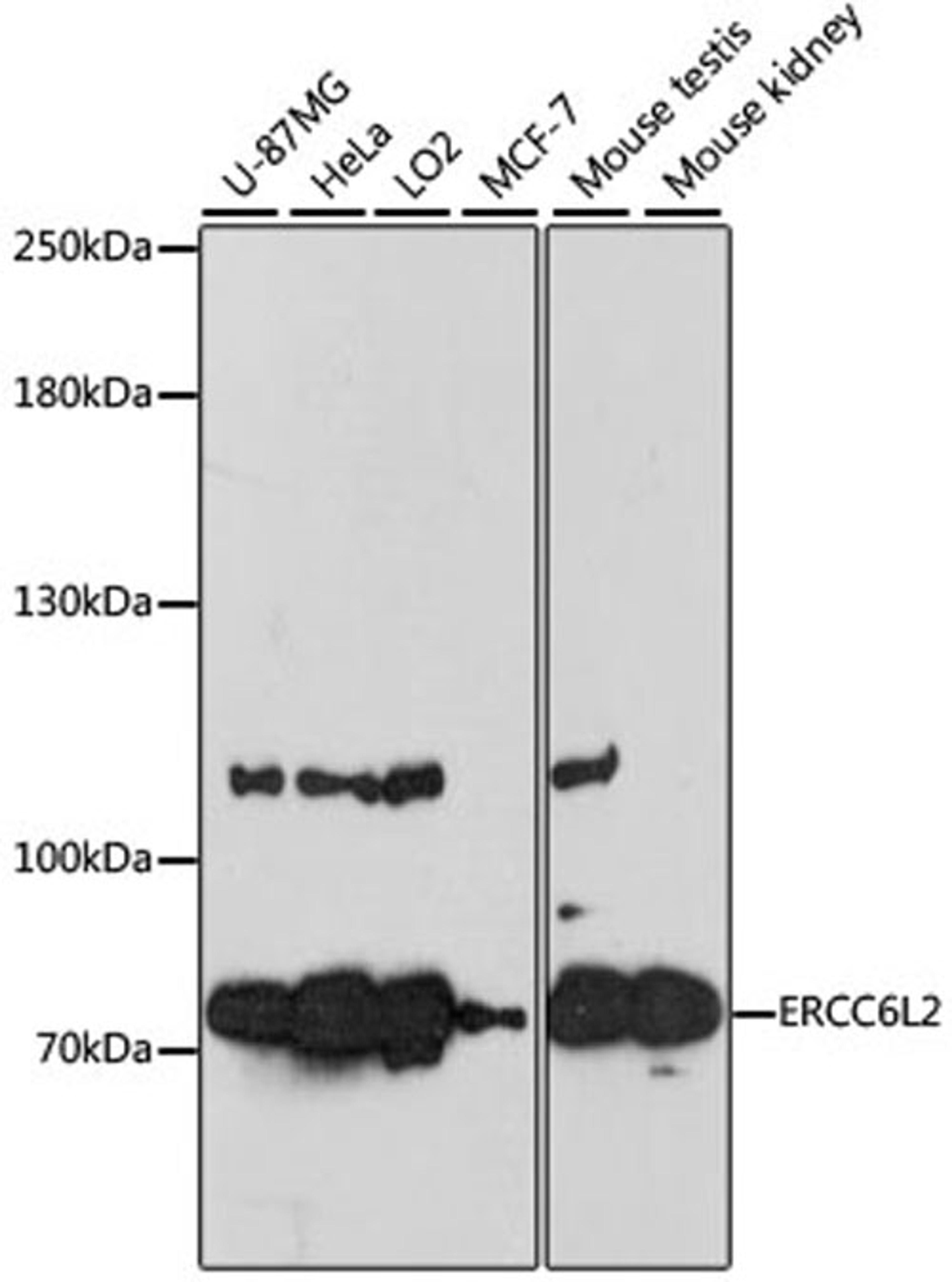 Western blot - ERCC6L2 antibody (A13144)