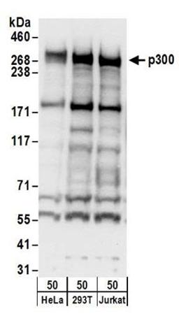 Detection of human p300 by western blot.