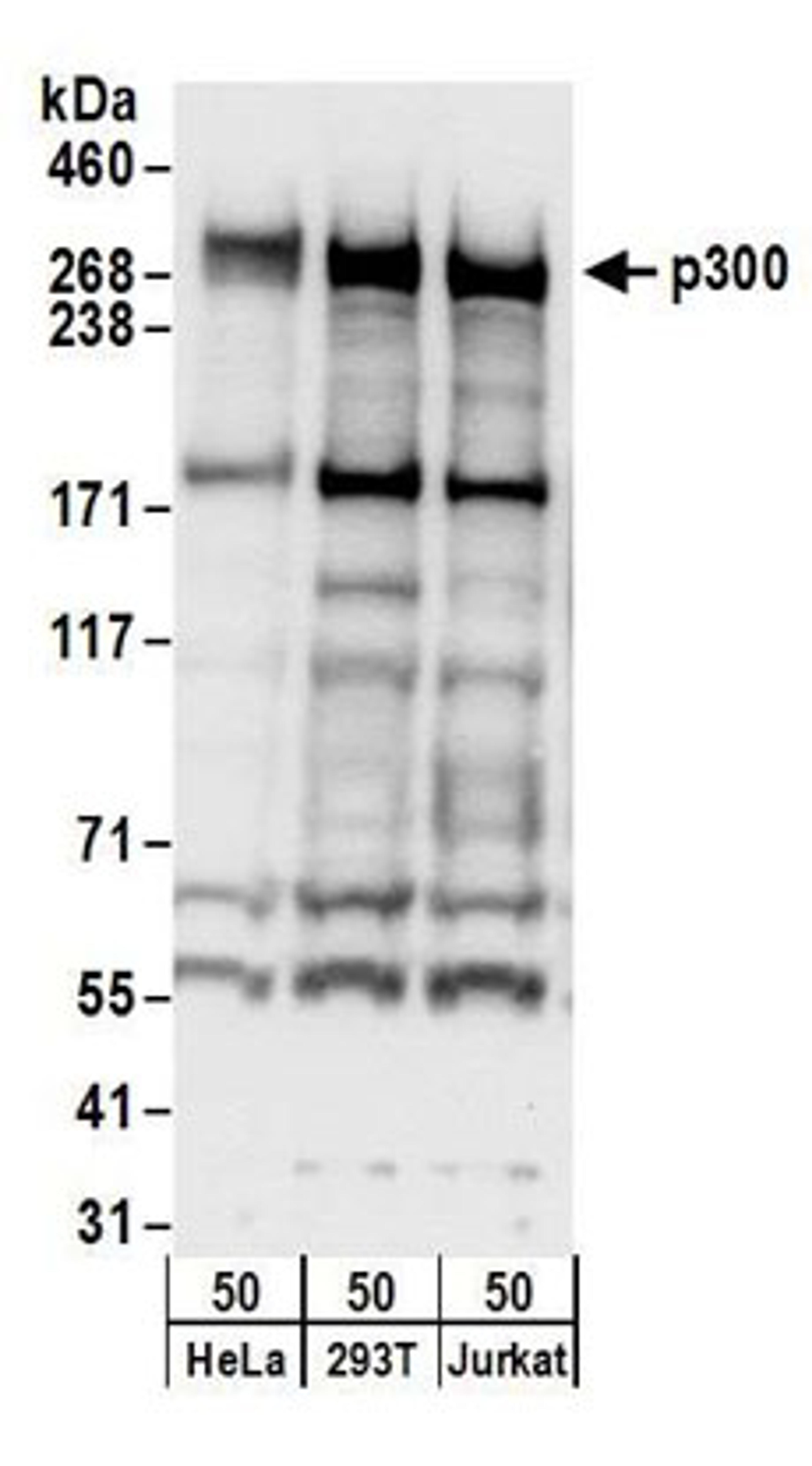 Detection of human p300 by western blot.