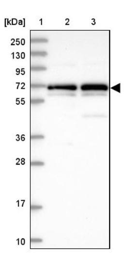 Western Blot: TROAP Antibody [NBP1-92532] - Lane 1: Marker [kDa] 250, 130, 95, 72, 55, 36, 28, 17, 10<br/>Lane 2: Human cell line RT-4<br/>Lane 3: Human cell line U-251MG sp