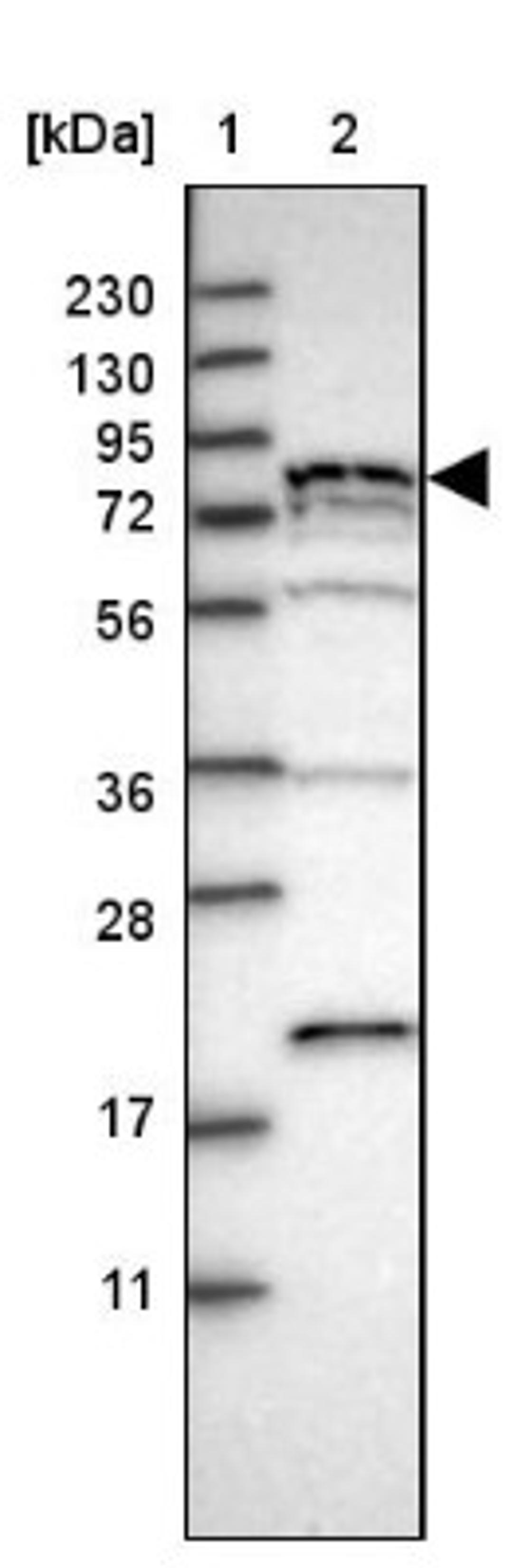 Western Blot: PNPLA8 Antibody [NBP1-83098] - Lane 1: Marker [kDa] 230, 130, 95, 72, 56, 36, 28, 17, 11<br/>Lane 2: Human cell line RT-4