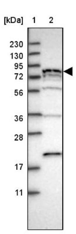 Western Blot: PNPLA8 Antibody [NBP1-83098] - Lane 1: Marker [kDa] 230, 130, 95, 72, 56, 36, 28, 17, 11<br/>Lane 2: Human cell line RT-4