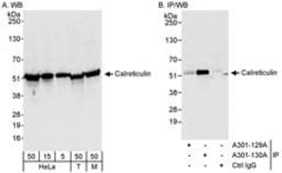 Detection of human and mouse Calreticulin by western blot (h&m) and immunoprecipitation (h).