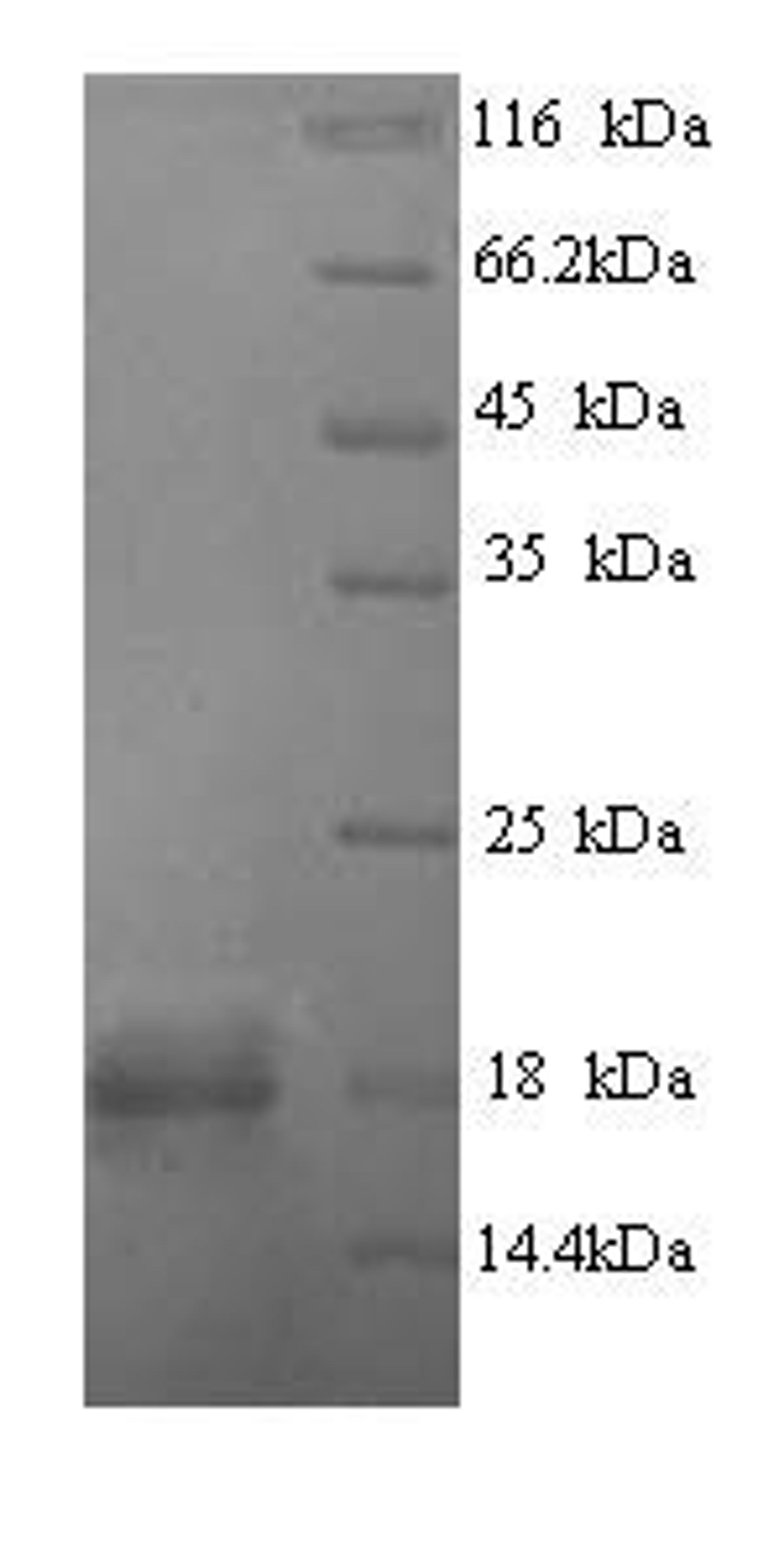 (Tris-Glycine gel) Discontinuous SDS-PAGE (reduced) with 5% enrichment gel and 15% separation gel.