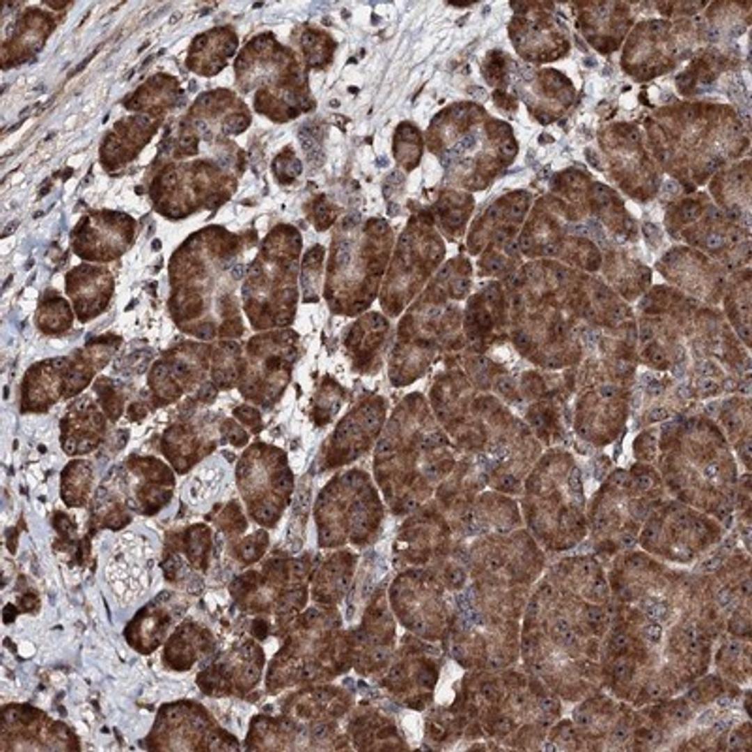 Immunohistochemistry-Paraffin: FAM111A Antibody [NBP1-82103] - Staining of human pancreas shows strong cytoplasmic and nucleolar positivity in exocrine glandular cells.