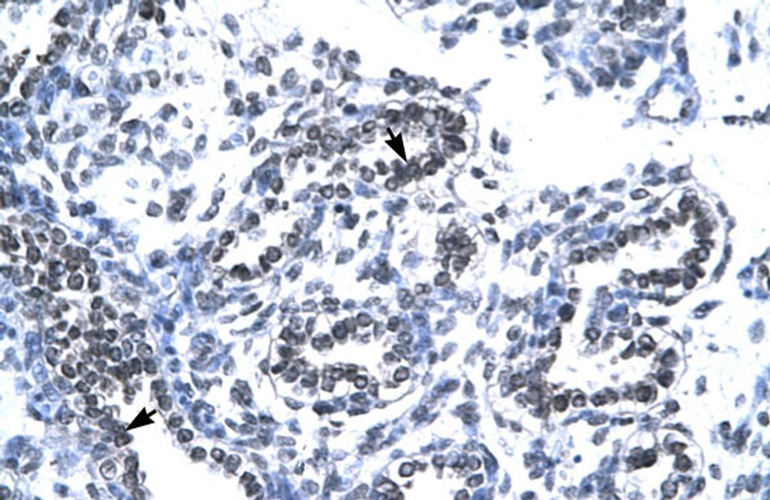 Antibody used in IHC on Human Lung.