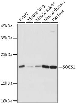 Western blot - SOCS1 Rabbit pAb (A7754)