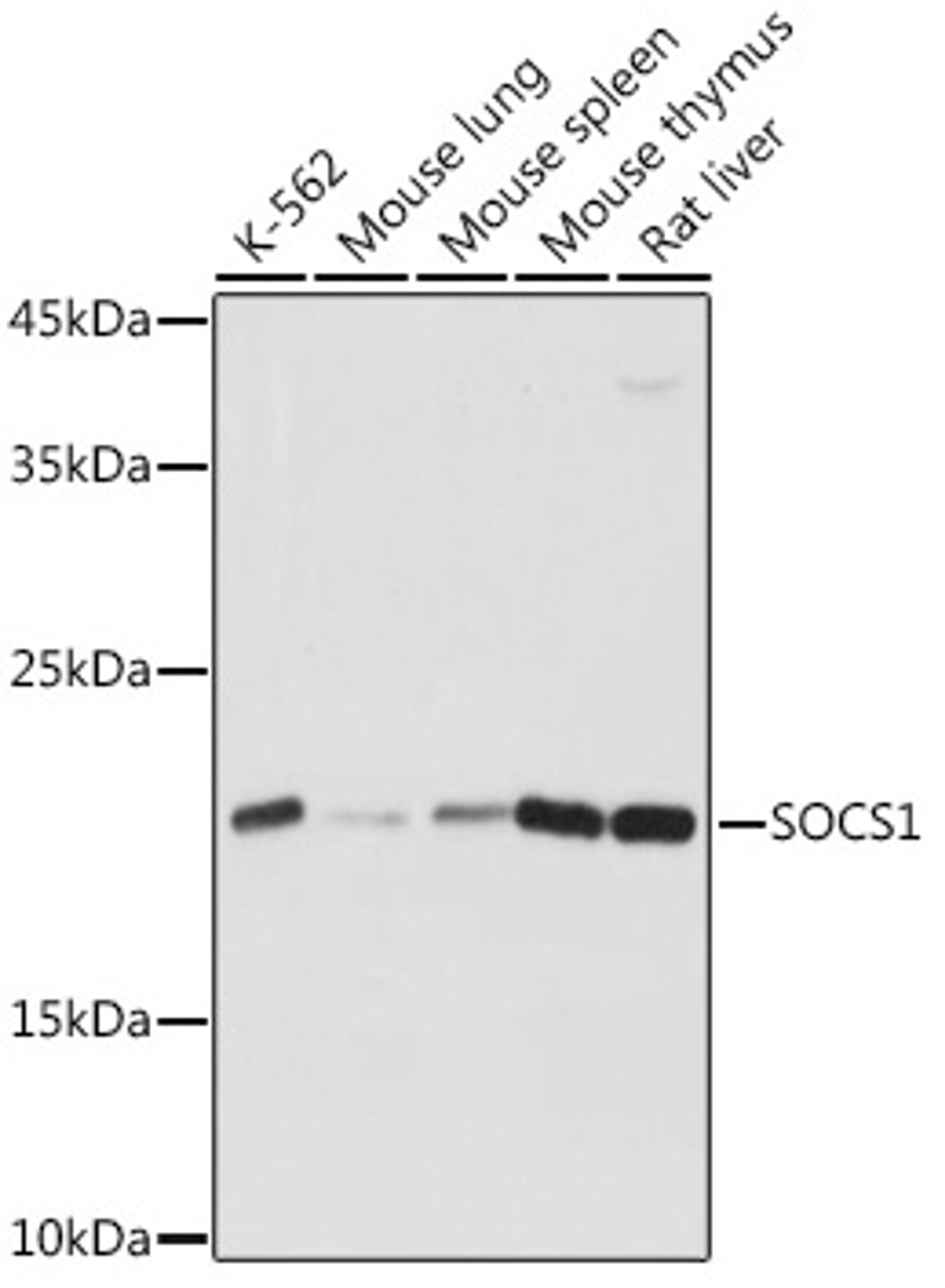 Western blot - SOCS1 Rabbit pAb (A7754)