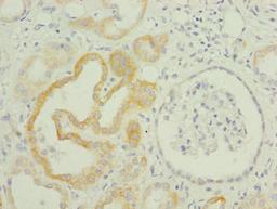 Immunohistochemistry of paraffin-embedded human kidney tissue using CSB-PA023863LA01HU at dilution of 1:100